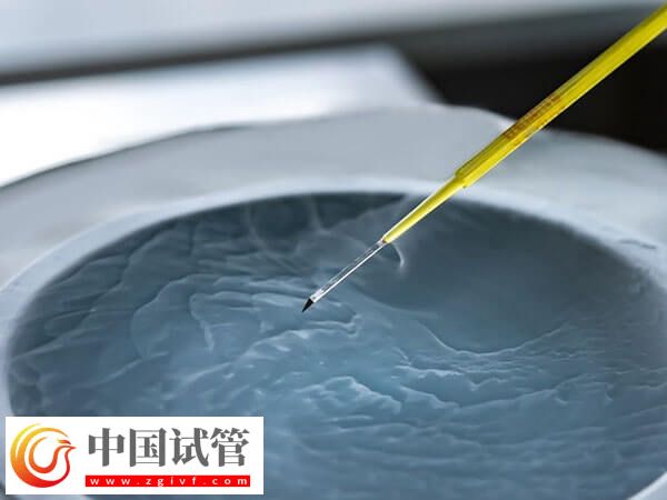 新乡供卵试管婴儿2个月就能完成,但这五个步骤可不能忽视(图2) 新乡供卵试管婴儿2个月就能完成,但这五个步骤可不能忽视(图2)