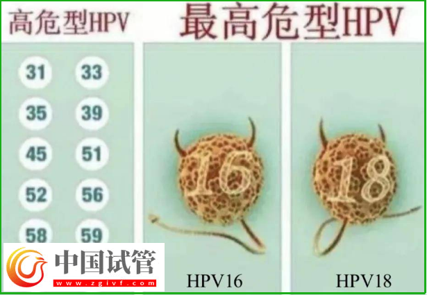 通过hpv报告单图片怎么判断自己是正常的呢?(图3) 通过hpv报告单图片怎么判断自己是正常的呢?(图3)