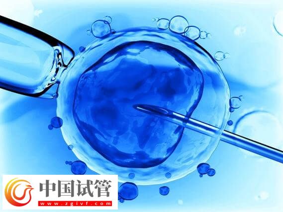 阜新细河区试管婴儿哪家比较好呢?(图1) 阜新细河区试管婴儿哪家比较好呢?(图1)