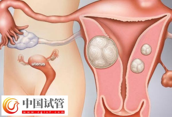 没有子宫能生孩子吗(图1)