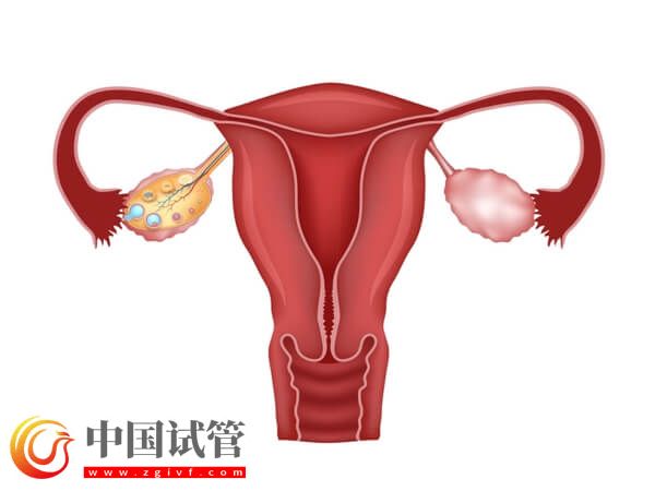 没有子宫能生孩子吗(图8)