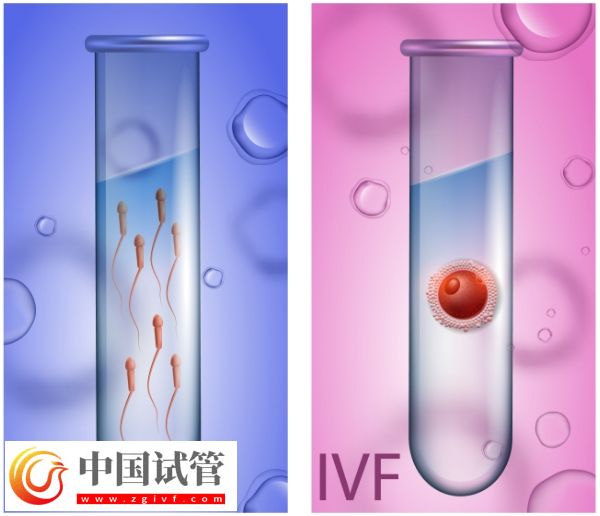 天津试管婴儿费用详解：全面了解价格及影响因素(图1)