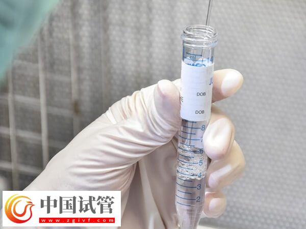 兰州供卵做三代试管婴儿费用多少(图1) 兰州供卵做三代试管婴儿费用多少(图1)