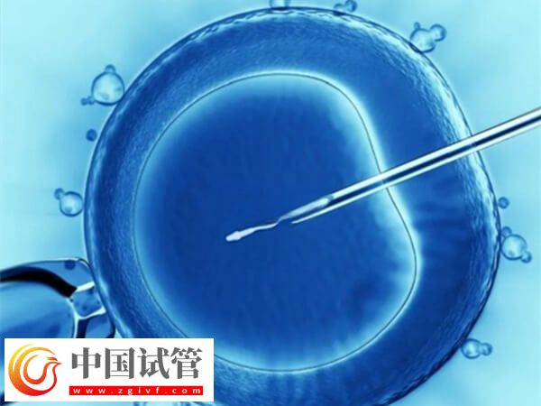 徐州试管成功率高不高(图1) 徐州试管成功率高不高(图1)