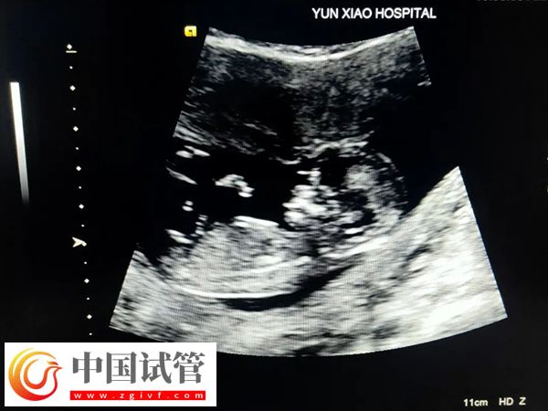 郑州市妇幼保健院试管生男女费用(图1) 郑州市妇幼保健院试管生男女费用(图1)