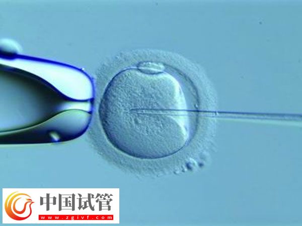 泰国试管婴儿能活多久(图1) 泰国试管婴儿能活多久(图1)