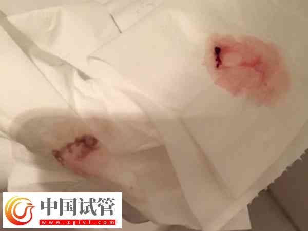 广州冻卵是否合法(图3) 广州冻卵是否合法(图3)