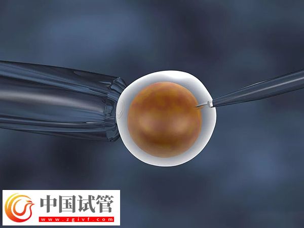 2025在西班牙做试管婴儿需要什么条件(图3) 2025在西班牙做试管婴儿需要什么条件(图3)