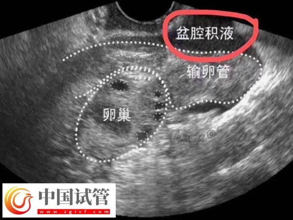 2025在西班牙做试管婴儿需要什么条件(图4) 2025在西班牙做试管婴儿需要什么条件(图4)