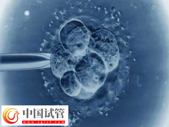 2025西班牙试管婴儿技术怎样(图1) 2025西班牙试管婴儿技术怎样(图1)