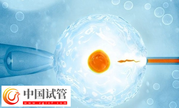 杭州医保试管是否报销(图1) 杭州医保试管是否报销(图1)