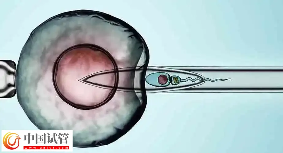 济南做试管婴儿成功率较高的医院前三名:济南第一人民医院排第一(图3) 济南做试管婴儿成功率较高的医院前三名:济南第一人民医院排第一(图3)