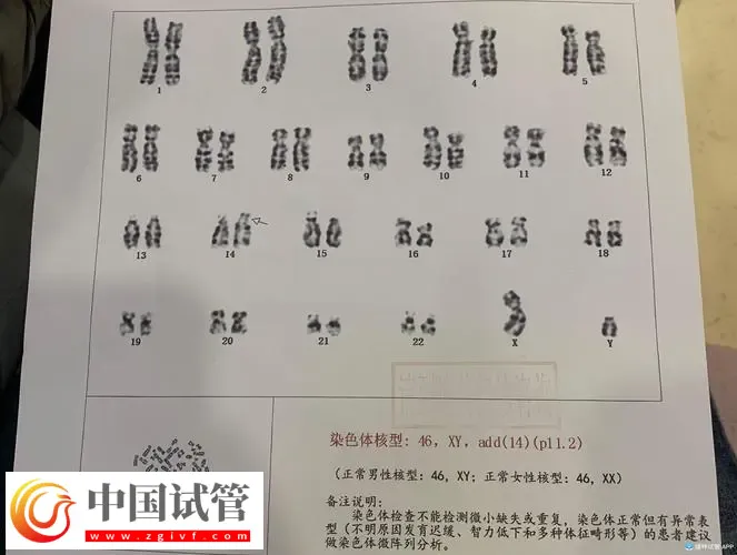 广州做染色体检查多少钱?广东省妇幼保健院约230-3300元左右(图2) 广州做染色体检查多少钱?广东省妇幼保健院约230-3300元左右(图2)