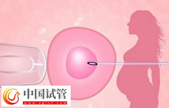 广州哪家做试管婴儿可以包怀上的?首选中山大学附属第一医院(图3) 广州哪家做试管婴儿可以包怀上的?首选中山大学附属第一医院(图3)