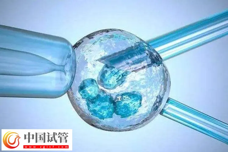 北京试管助孕大概要多少钱?这是2024最新收费标准(图3) 北京试管助孕大概要多少钱?这是2024最新收费标准(图3)