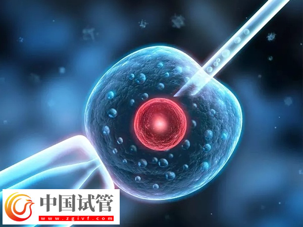 前往俄罗斯做试管合不合法(图2) 前往俄罗斯做试管合不合法(图2)