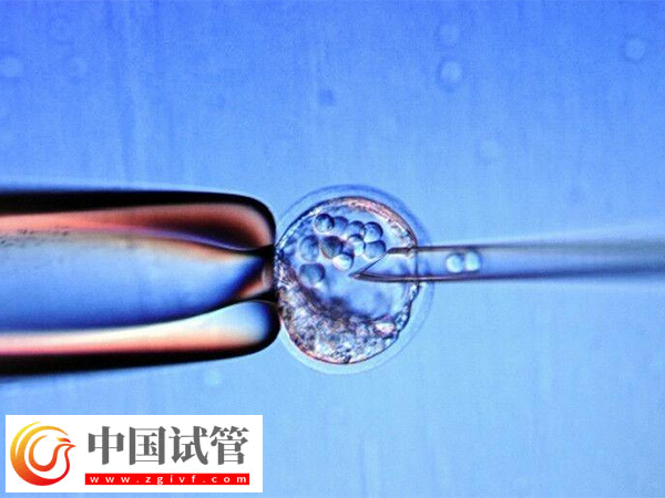 为什么俄罗斯试管成功率那么高(图2) 为什么俄罗斯试管成功率那么高(图2)