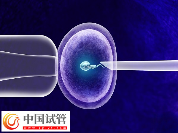 乌克兰做试管怎么防止被骗(图2) 乌克兰做试管怎么防止被骗(图2)