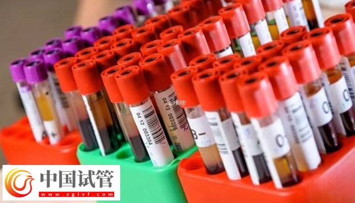 乌克兰做试管怎么防止被骗(图3) 乌克兰做试管怎么防止被骗(图3)