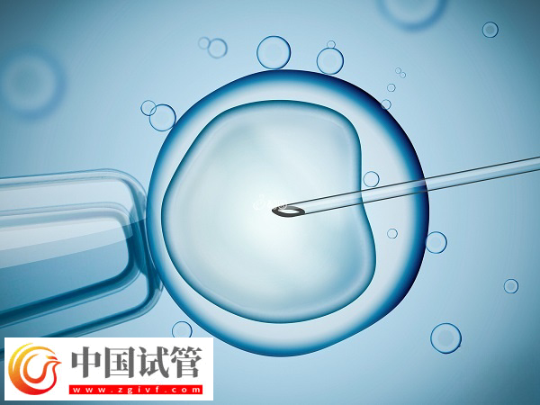 夫妻去美国做试管怎么选择医院(图1) 夫妻去美国做试管怎么选择医院(图1)