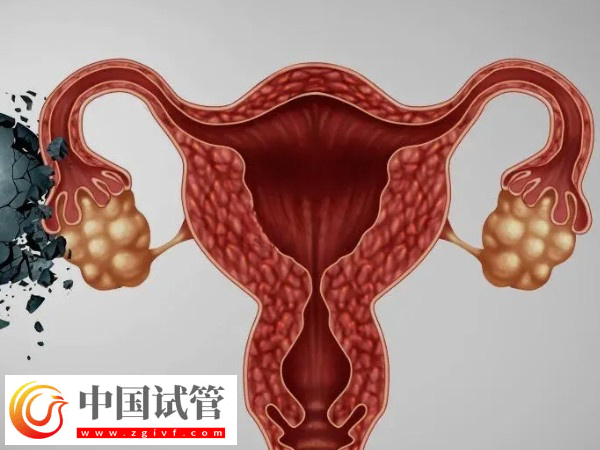 夫妻去美国做试管怎么选择医院(图5) 夫妻去美国做试管怎么选择医院(图5)