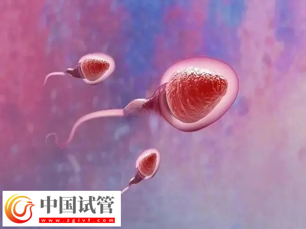 试管婴儿是不是从试管中出来的(图1) 试管婴儿是不是从试管中出来的(图1)