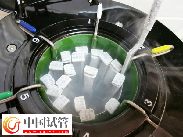 泰国冷冻胚胎保存多久(图2) 泰国冷冻胚胎保存多久(图2)