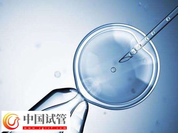 兰州试管婴儿费用大概要多少钱(图2) 兰州试管婴儿费用大概要多少钱(图2)