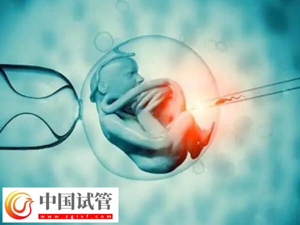 澳门试管成功率高不高(图1) 澳门试管成功率高不高(图1)