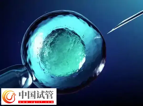 北京和上海做试管哪个技术好(图2) 北京和上海做试管哪个技术好(图2)