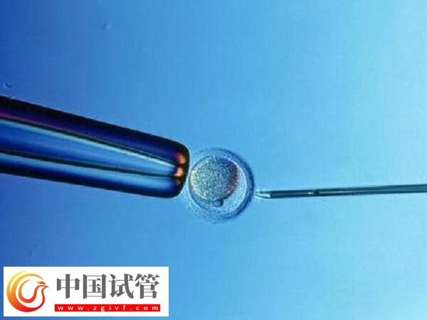 北京试管婴儿成功率最高的医院是哪个(图1) 北京试管婴儿成功率最高的医院是哪个(图1)