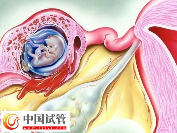 试管移植第三天出血是不是着床了(图1) 试管移植第三天出血是不是着床了(图1)