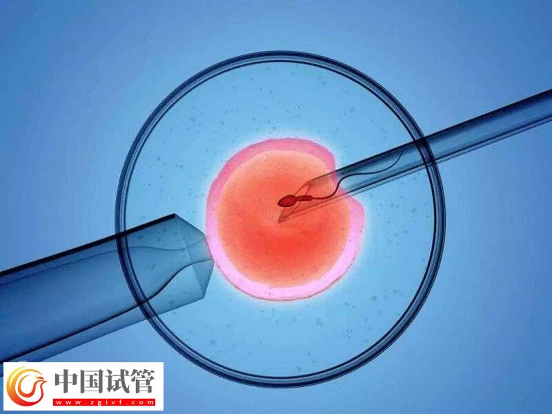 人工授精跟试管婴儿有什么区别(图1)